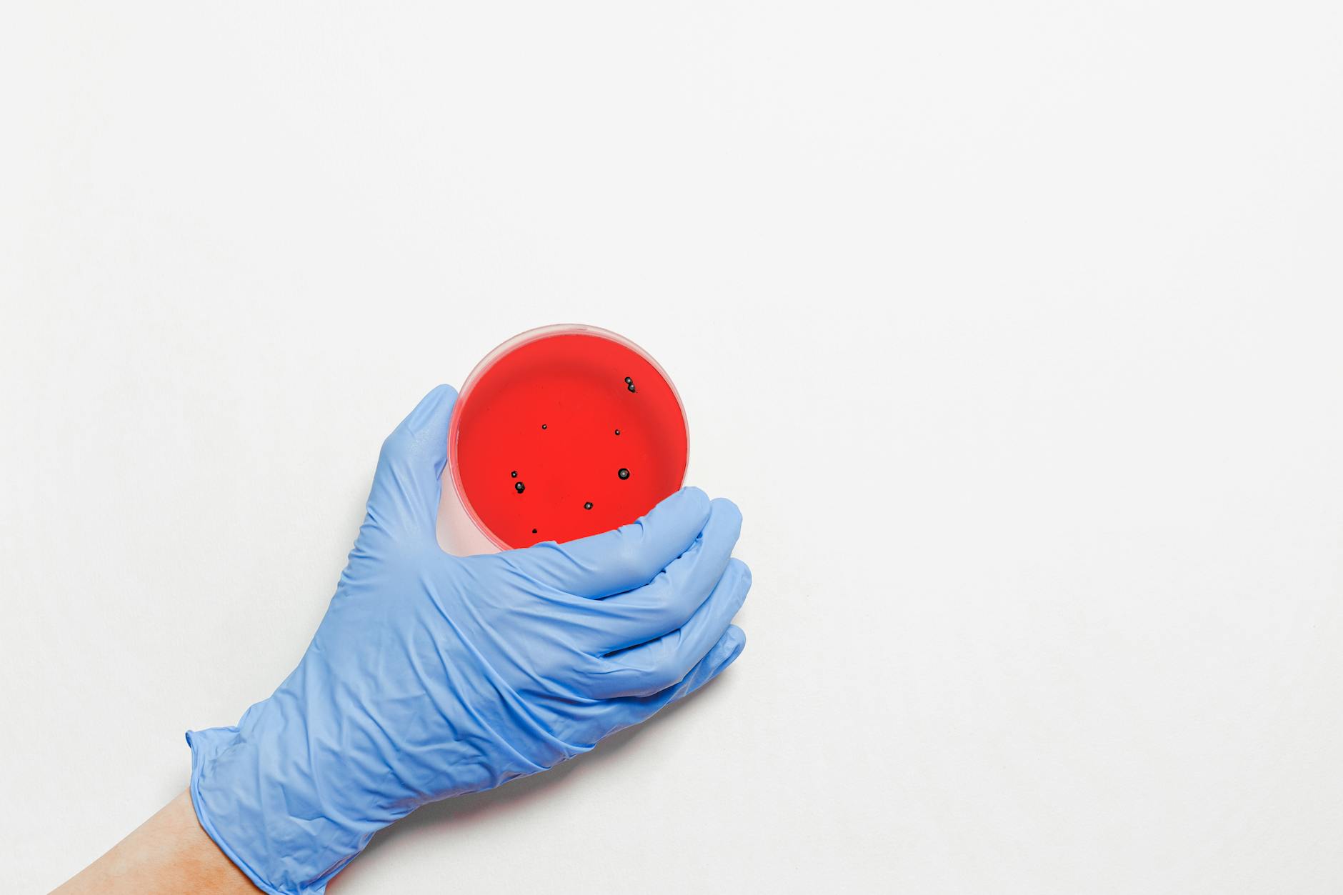 Gut microbiome laboratory petri dish science — Akkermansia muciniphila research
