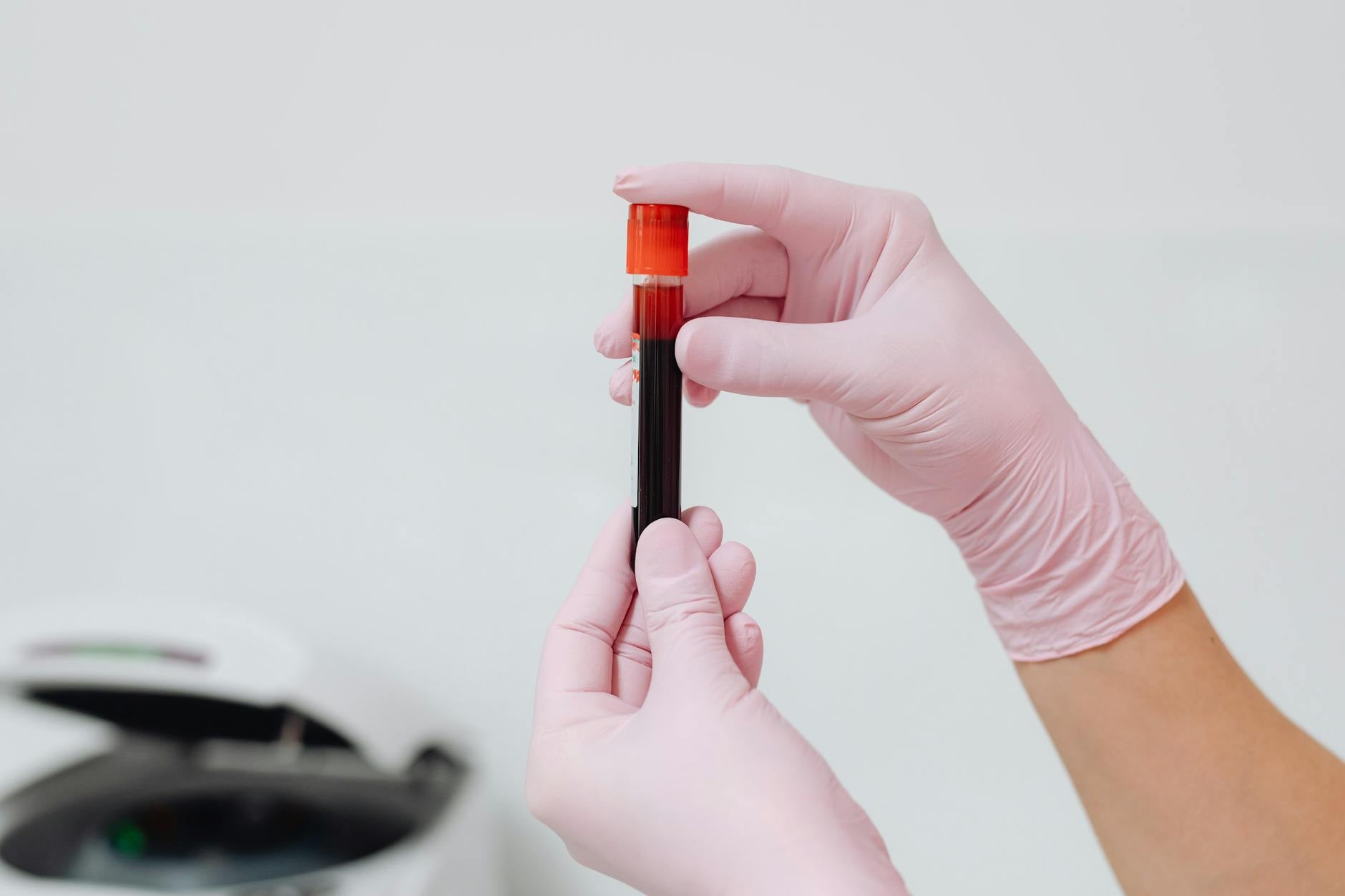 Doctor reviewing cholesterol and lipid panel blood test results — ApoB cardiovascular risk assessment